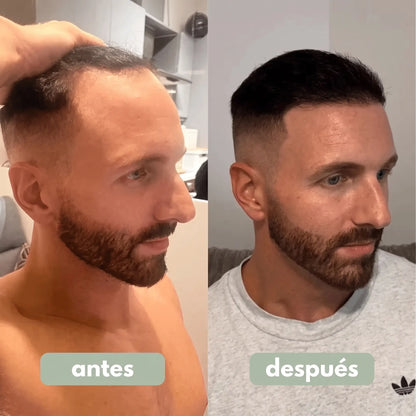Sérum para o Crescimento do Cabelo