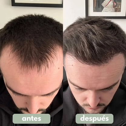 Sérum para o Crescimento do Cabelo
